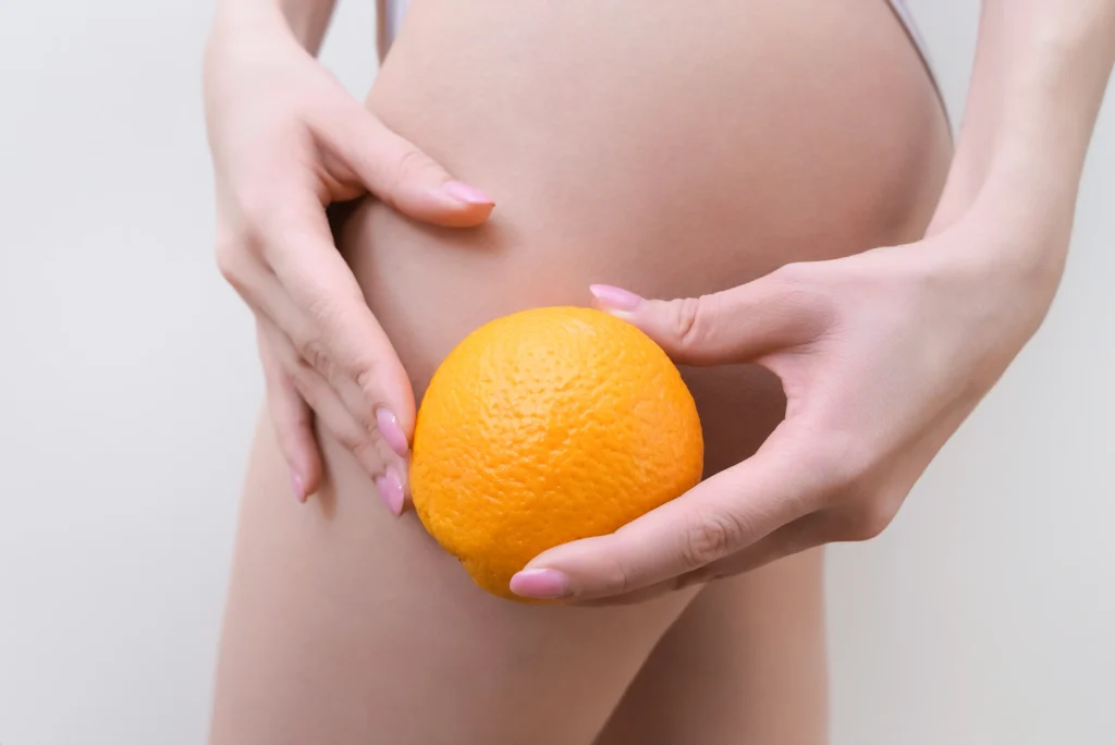 Kobieta trzyma pomarańczę na tle skóry, problem skórki pomarańczowej, cellulitu